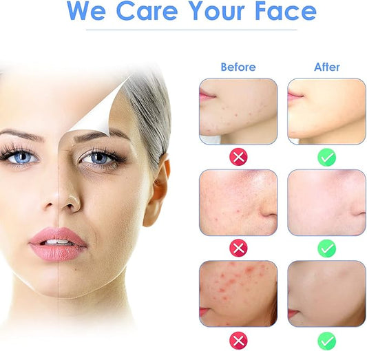 3-in-1 Ultrasonic Facial Skin Scrubber